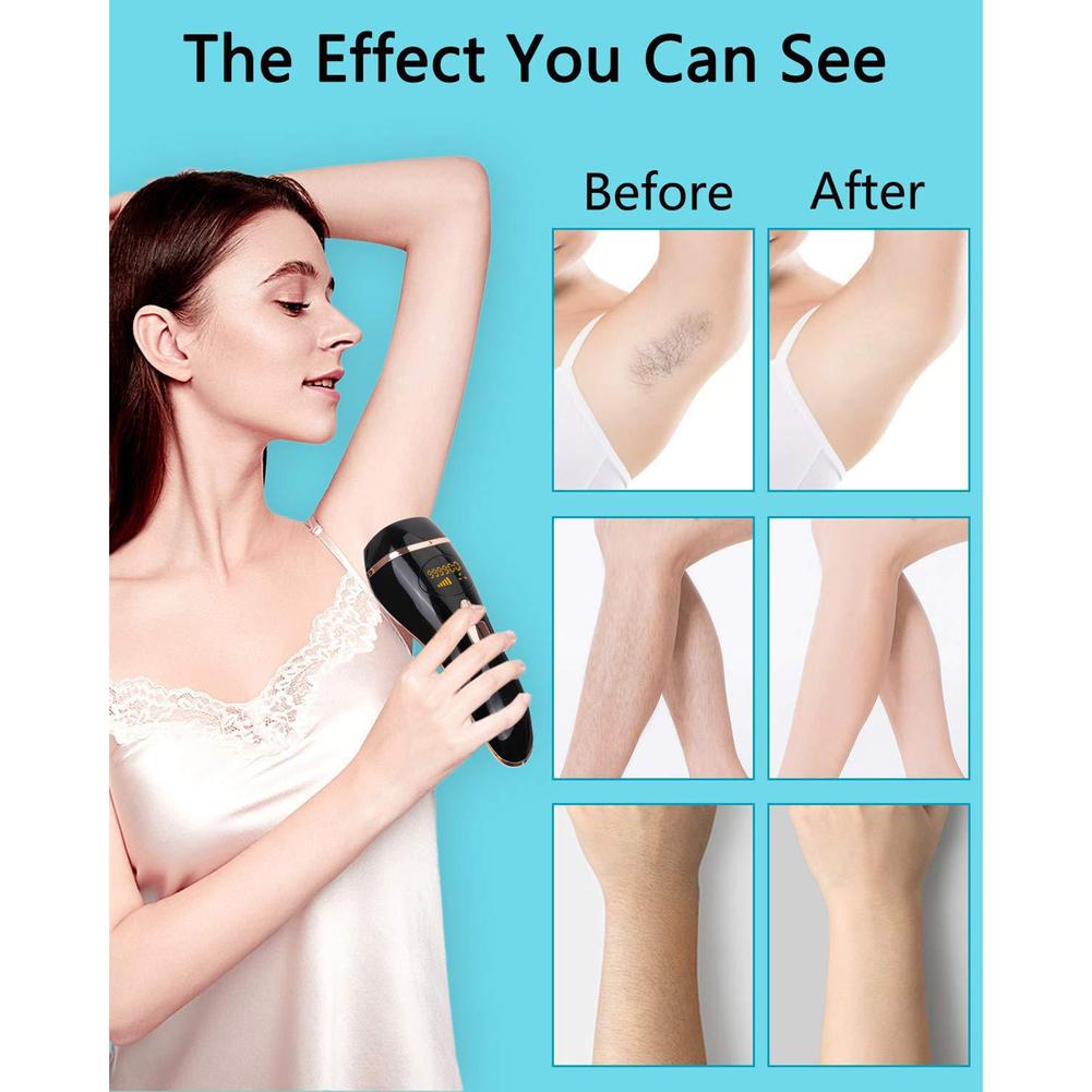 Laser Hair Remover with Fee Razor and Goggles