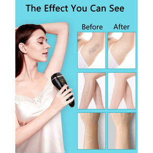 Laser Hair Remover with Fee Razor and Goggles